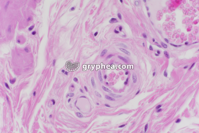 Vaisseaux lymphatiques x200 - gryphea.org